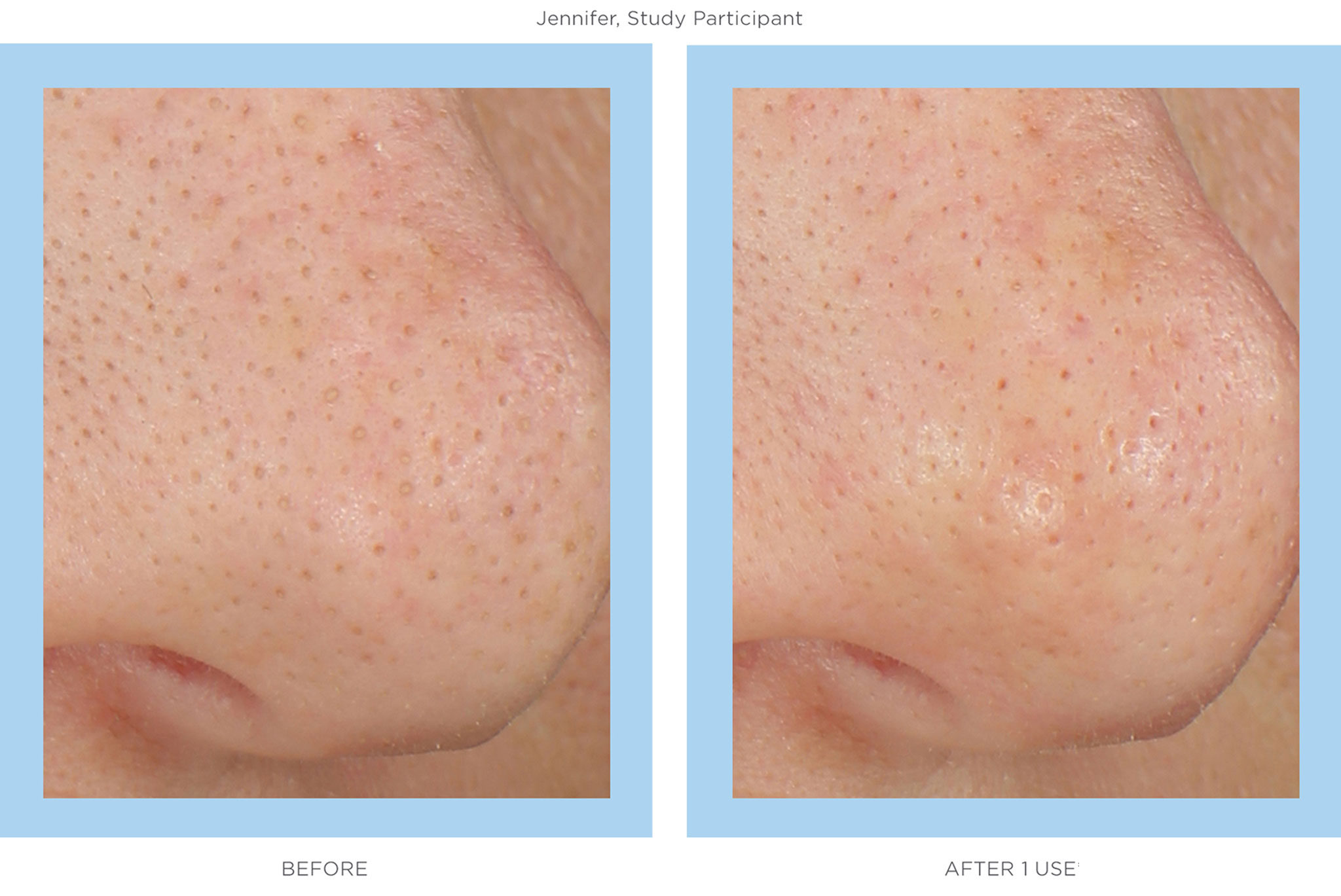 Unclog Your Pores with New Pore Cleansing MD System | Rodan + Fields ...