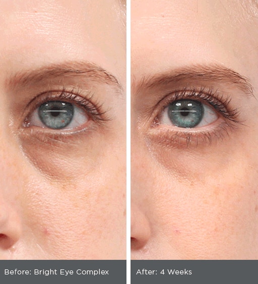 Rodan + Fields Active Hydration Bright Eye Complex cream before and after results