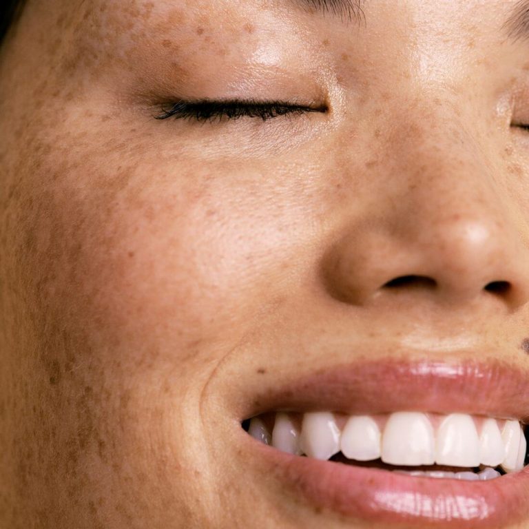 Closeup of young woman with freckled skin and eyes closed
