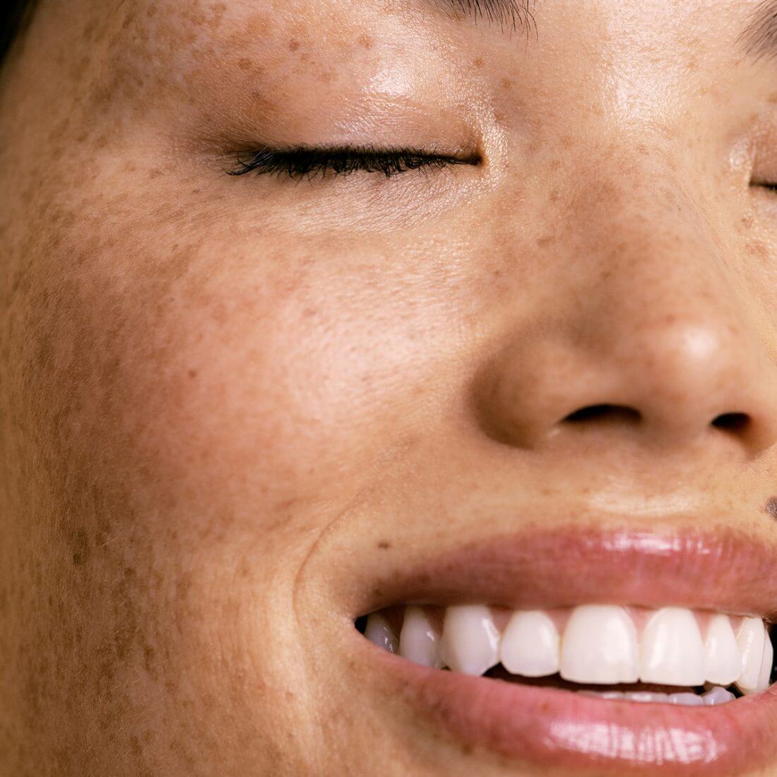 Closeup of young woman with freckled skin and eyes closed
