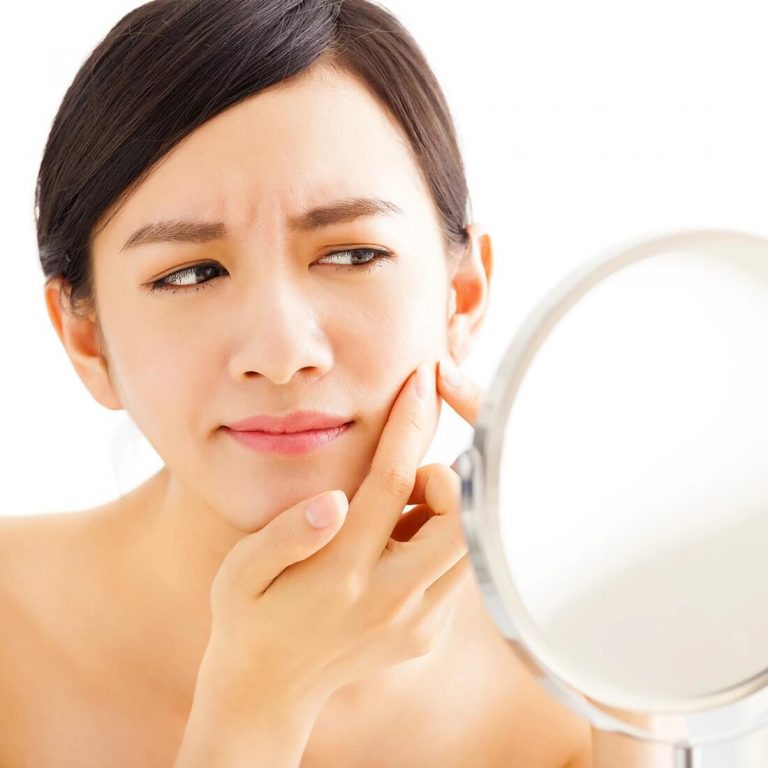 Woman inspecting an acne blemish on her cheek