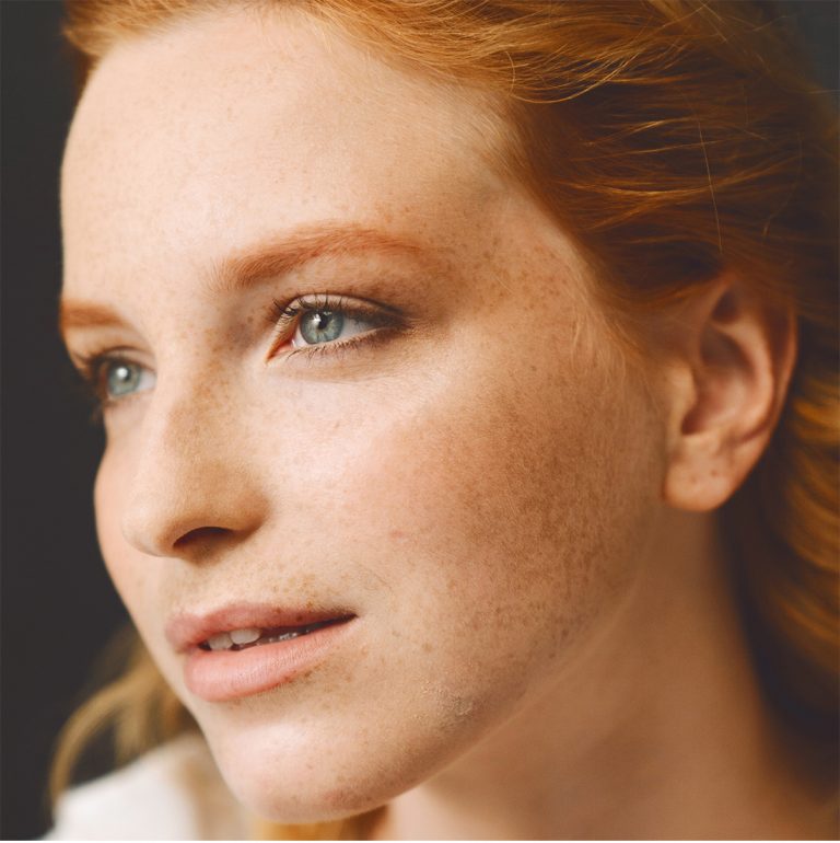Young woman with freckles