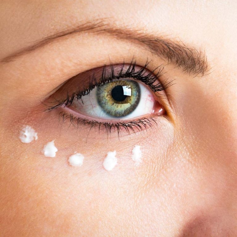 Closeup-up of a woman's eye with skincare product applied to under-eye area in a dotted pattern