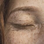 Vitamin C for Dark Spots & Hyperpigmentation