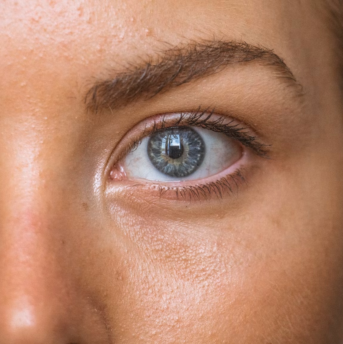 Best Hyaluronic Acid for Skin in 2026: Dry Skin, Acne & More - R+F