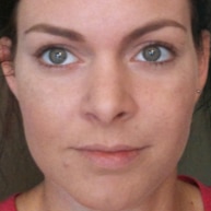 REVERSE Brightening Regimen - After