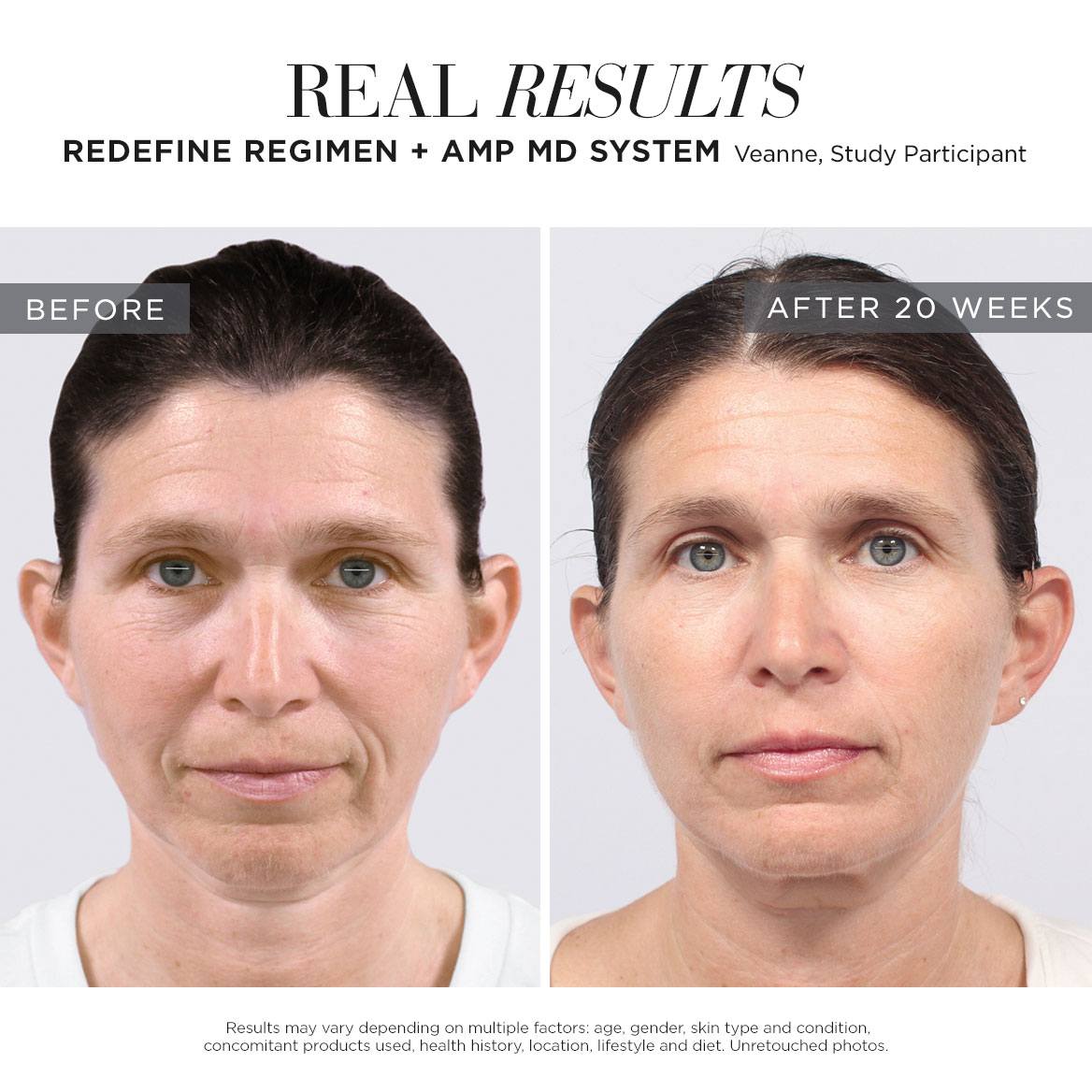REDEFINE AMP IT UP SPECIAL